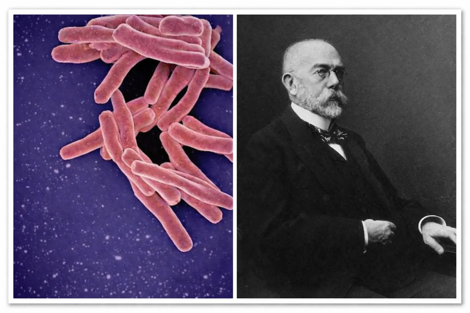 Robert koch and Tuberculosis Bacteria image 